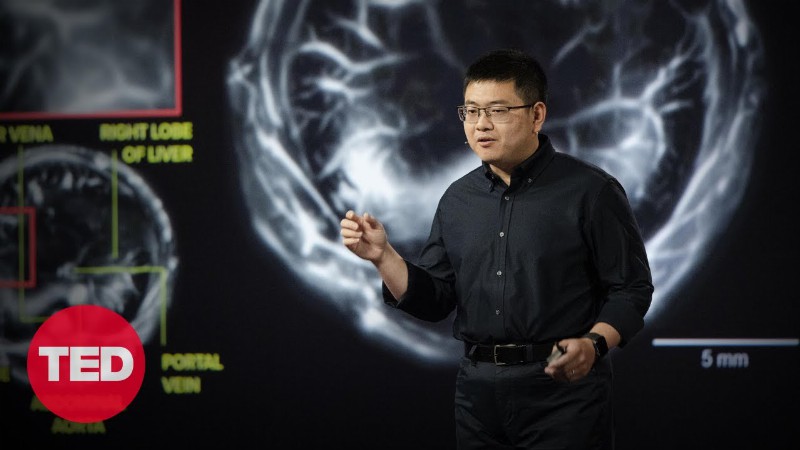 image 0 The Incredible Cancer-detecting Potential Of Photoacoustic Imaging : Lei Li : Ted